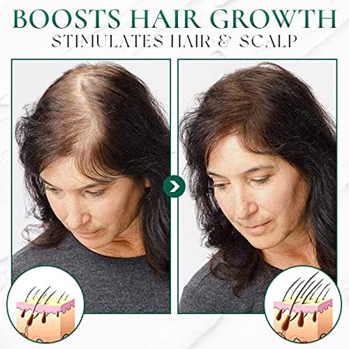 צמיחה מחודשת של צנטלה, פילינג פילינג לשיער, טיפול פילינג עדין בקרקפת, צמיחת שיער, הזנה וחלקה לשיער